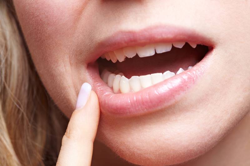 Woman with pain in her gums