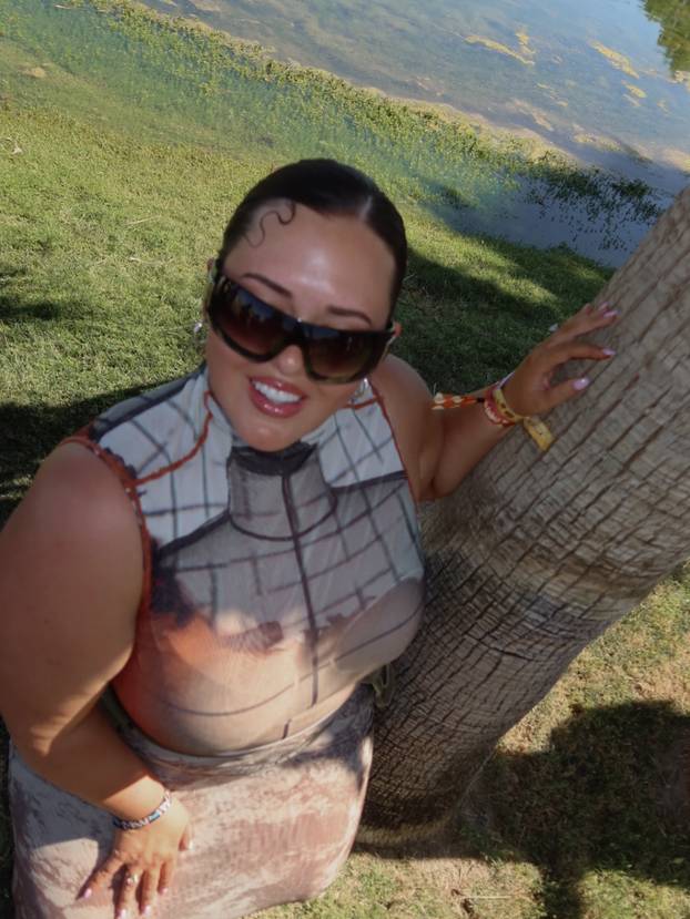 FOTO Ovaj model prkosi idealima i ruši stereotipe: 'Ne skrivam svoje tijelo, volim ga!'