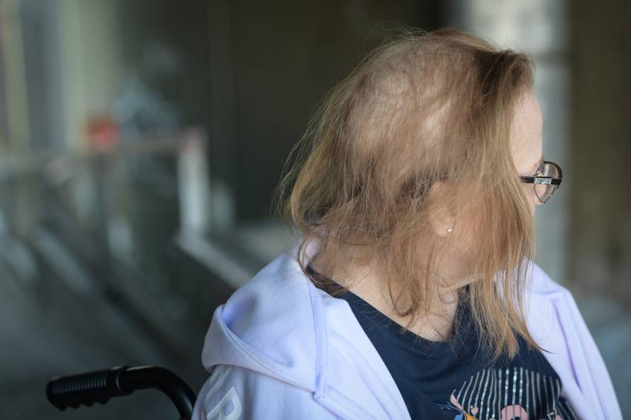 Zagrepčanka Tajana (49): Triput sam umirala od korone. Sada sam u invalidskim kolicima...