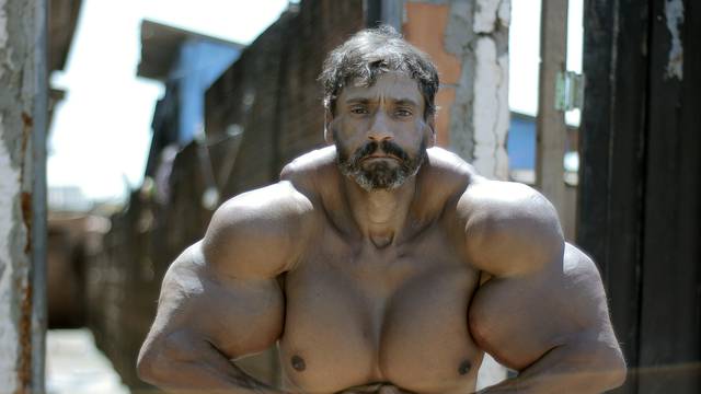 Incredible Bulk: Bodybuilder Injects Oil Into Enormous Muscles