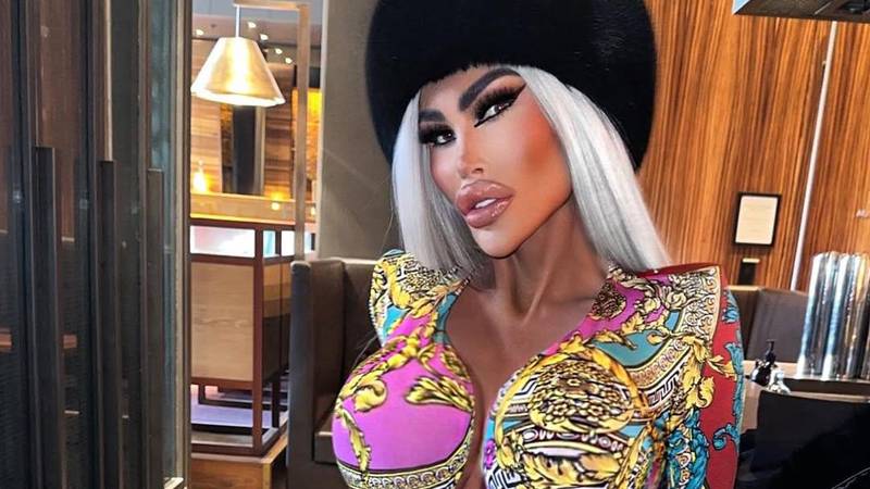 FOTO Potrošila više od 100 tisuća eura kako bi izgledala kao 'ljudska barbika' - Liječnici zgroženi