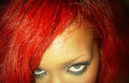 Crvenokosa Rihanna si je čelo spalila peglom za kosu