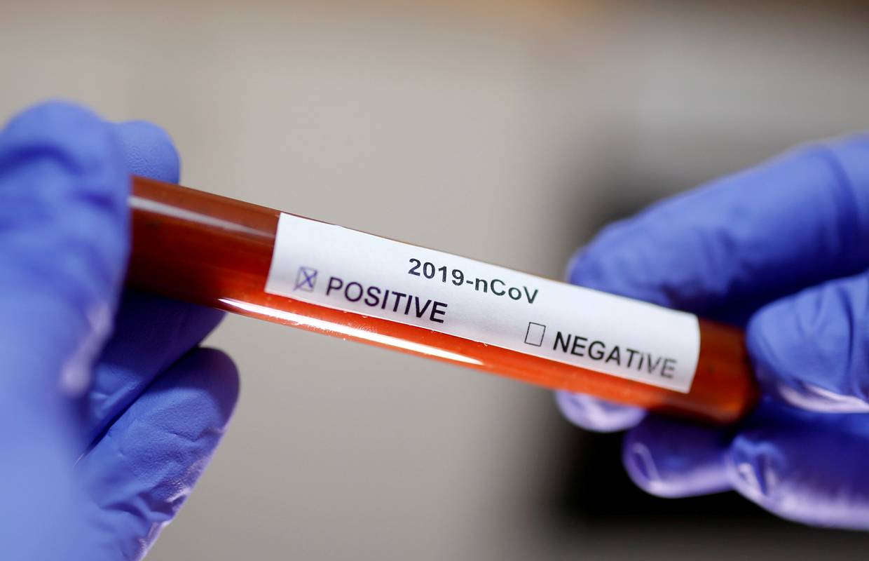 Izgubio bitku: S koronom se borio 154 dana, virus u njegovu tijelu mutirao čak 20 puta