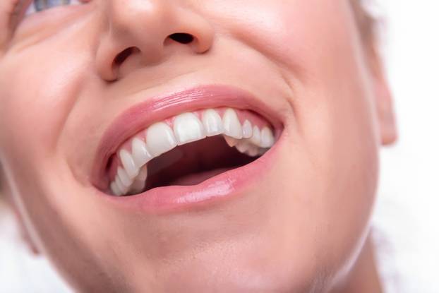 Female face with white teeth isolated on white.