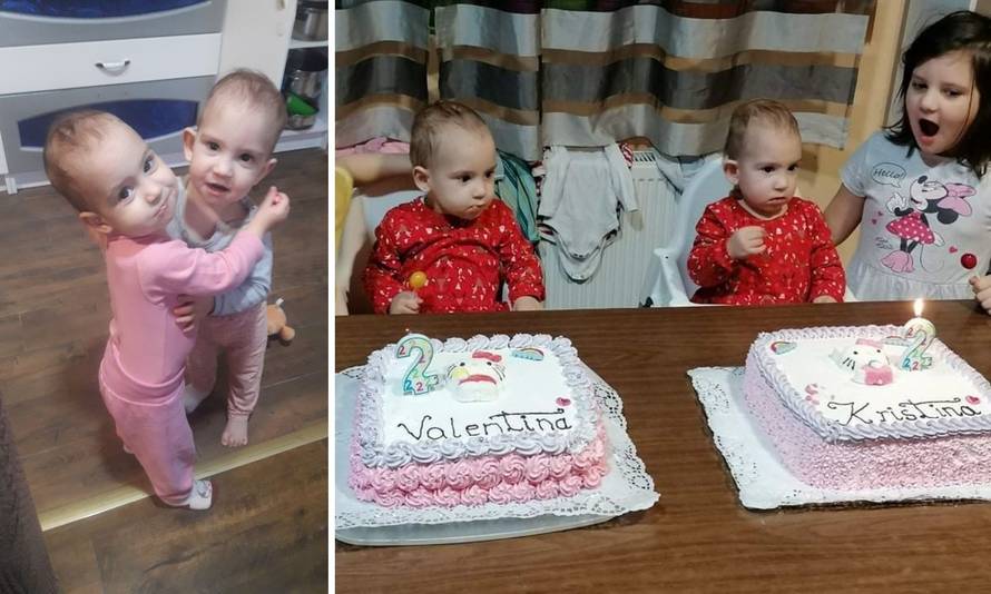 Sijamske blizanke: Seke su bile spojene, imale su zajedničku jetru, a danas su zdrave i vesele