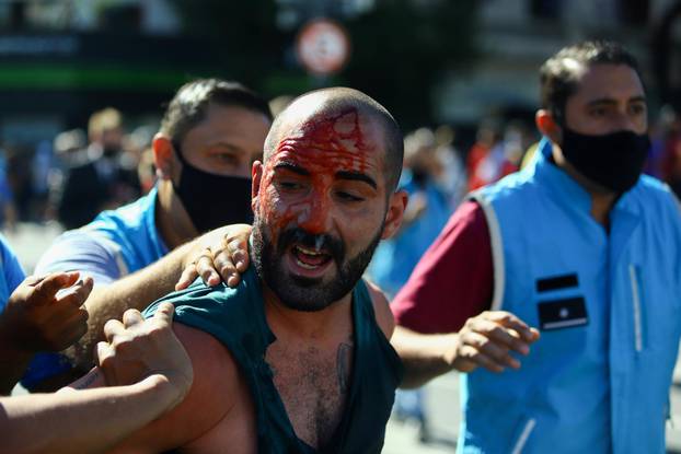 An injured man is helped by others during clashes with police while people were lining up for the wake of soccer legend Diego Maradona at the presidential palace Casa Rosada