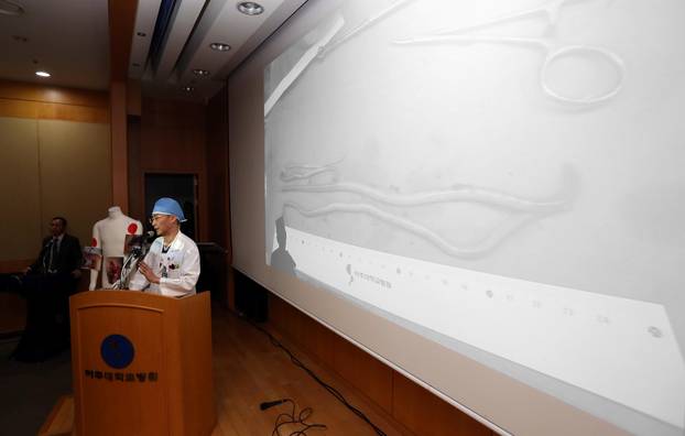 A surgeon Lee Cook-jong gives a briefing during a news conference at a hospital in Suwon