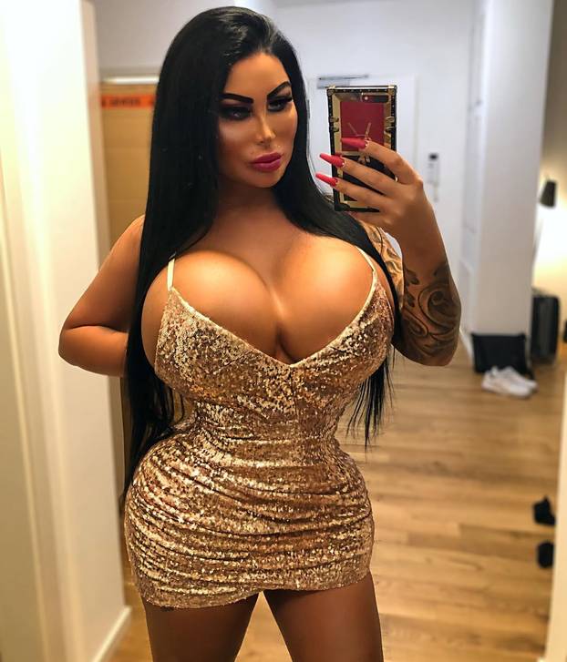 FOTO Barbie iz Berlina pobrala lovu bake pa ulupala 36.000 € u operacije: 'Ja sam umjetnost'