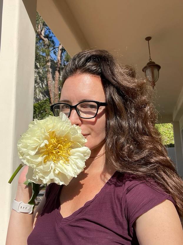 FOTO Charlotte iz serije "Seks i grad" priznala je korekcije lica, pogledajte kako se mijenjala