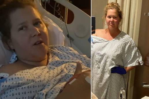 Glumica Amy Schumer: 'Morala sam izvaditi maternicu i  slijepo crijevo zbog endomtrioze'