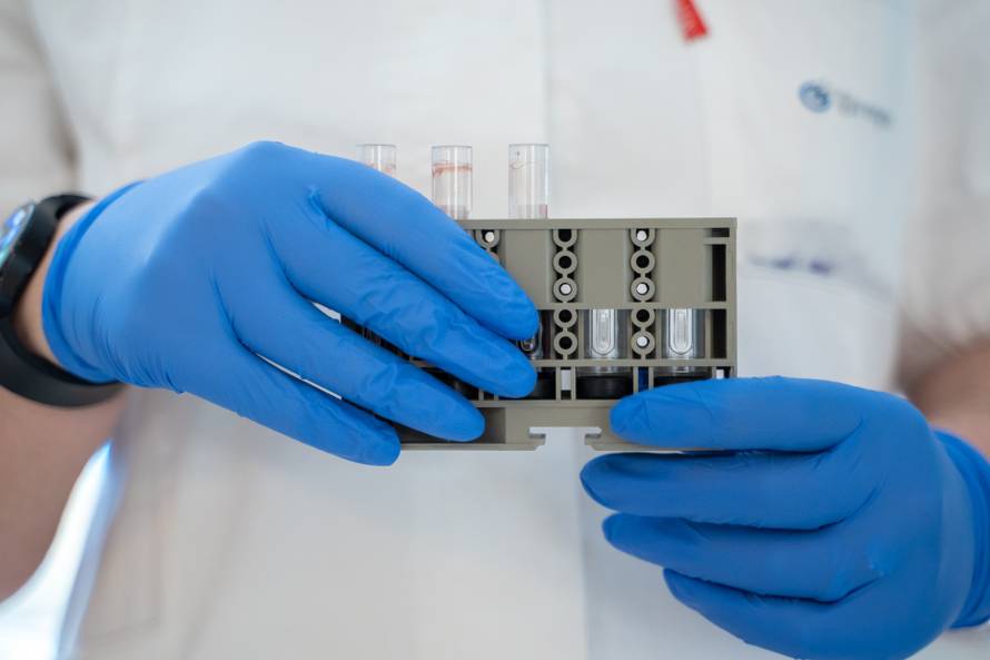 Znate li zašto su preventivne laboratorijske pretrage važne za Vaš organizam?