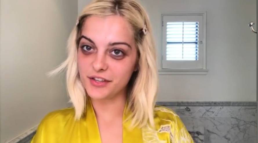 Albanka šokirala podočnjacima: 'To nije normalno, idi doktoru'