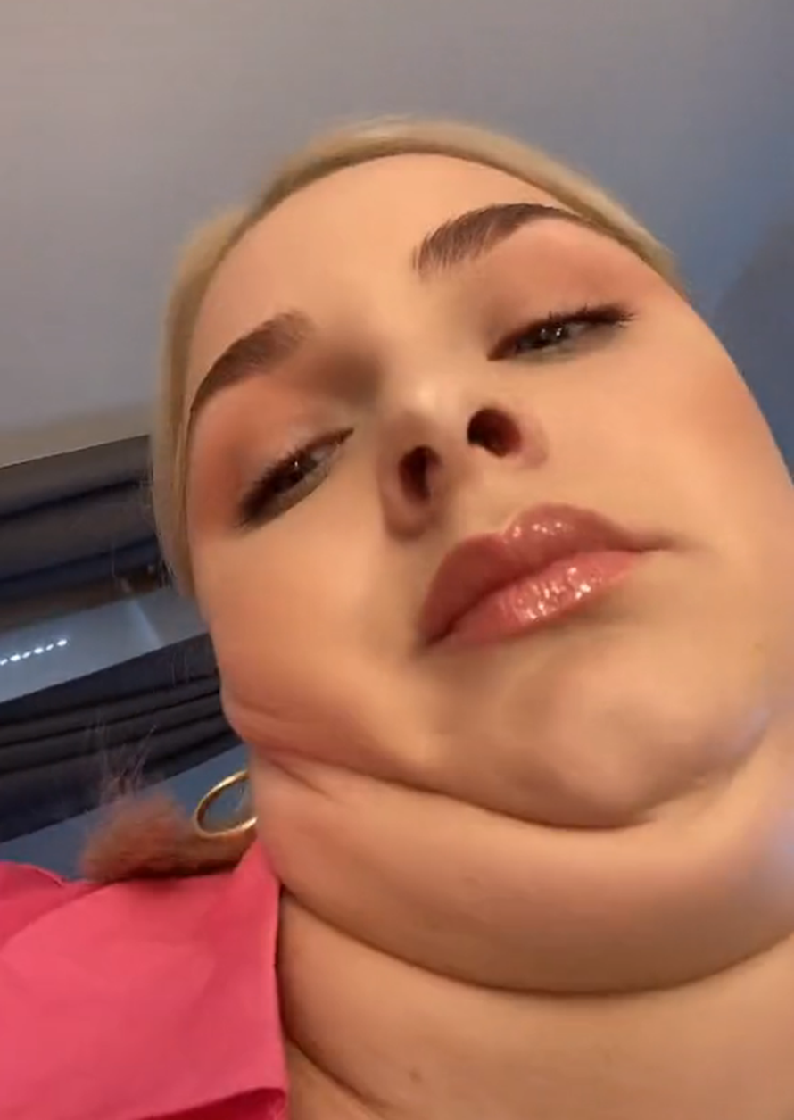 'Nekad sam bila jako nesigurna zbog podbratka, a danas zbog toga imam milijune pratitelja'