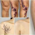 Tetovira ožiljke i tako pomaže ljudima vratiti samopouzdanje