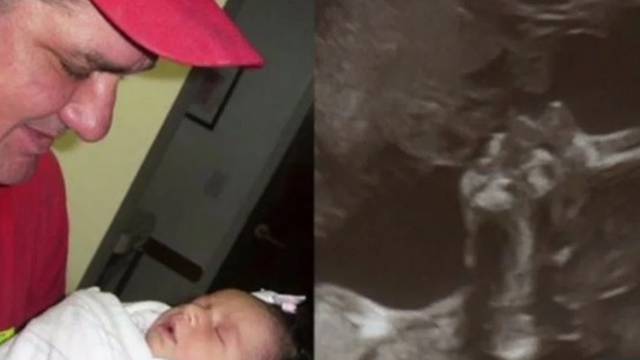 Na ultrazvuku svoje nerođene kćeri vidi siluetu pokojnog oca