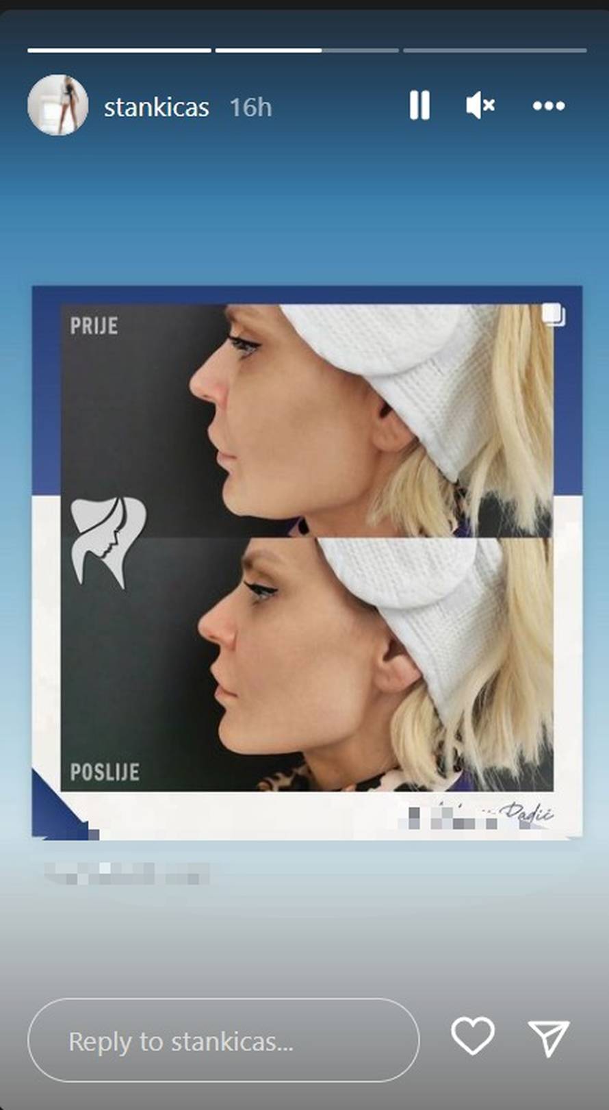 Evo kako je izgledala Stankica iz 'Savršenog' prije devet godina