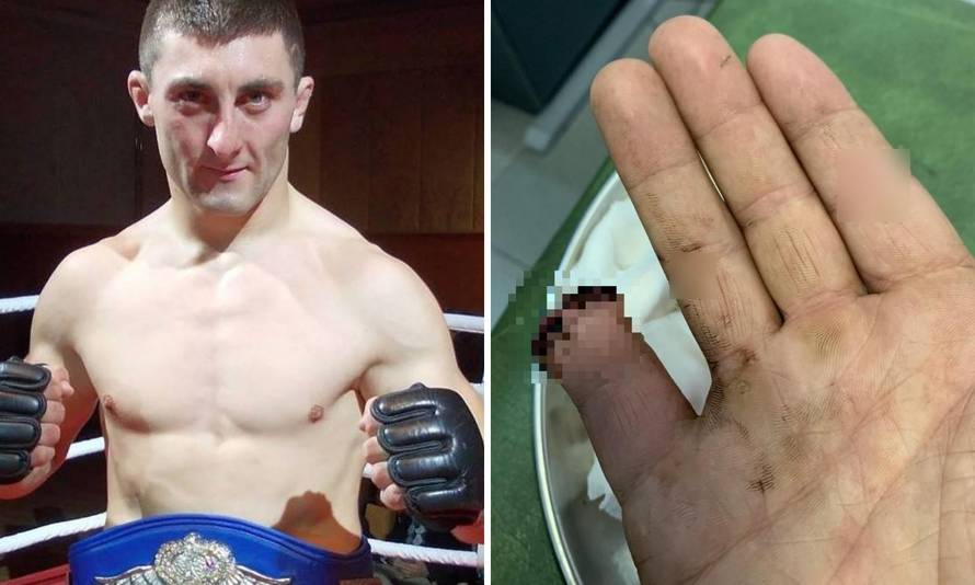 'Berač mi je otkinuo dio prsta, zamotao sam i nastavio berbu'