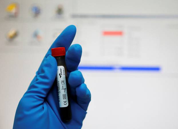 Technician holds test tube with blood sample at Russian anti-doping laboratory in Moscow