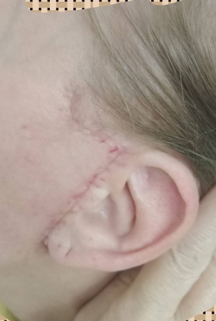 Estetski kirurg iz Zagreba htio ušutkati žene koje su se žalile na njega, stigla mu opomena!