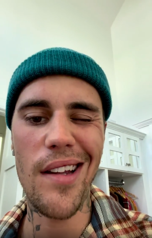 Justin Bieber oglasio se nakon što mu je lice paralizirano