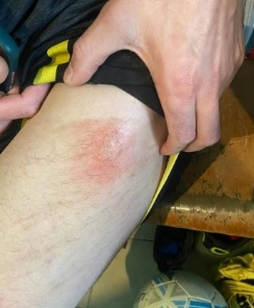 Domaćini pretukli goste jer su poveli u prvom poluvremenu: Uključili se redari i fizioterapeut