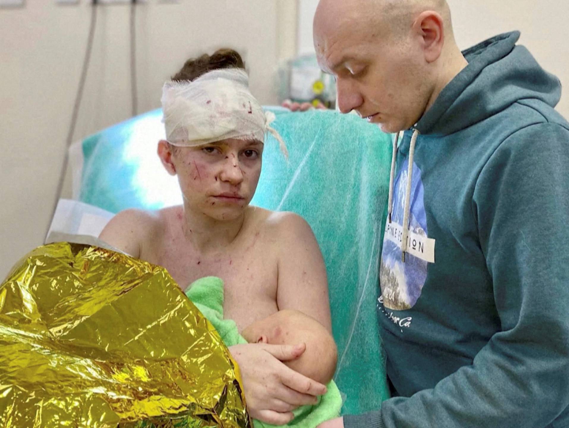 Olga, a 27-year-old Ukrainian woman seriously wounded while sheltering her baby from shrapnel blasts amid Russia's ongoing invasion of Ukraine, holds her baby Victoria as her husband Dmytro stands by her side in Kyiv