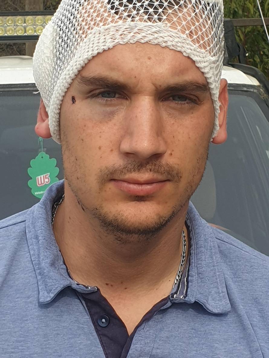 'Sreća je da me pogodio u čelo. Izgleda da me sam Bog spasio'