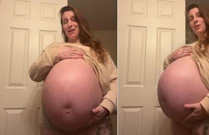 Žena trudna s jednim djetetom pokazala svoj ogromni trbuh - komentari ljudi su urnebesni