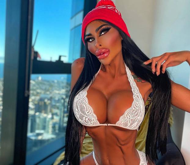 FOTO Potrošila više od 100 tisuća eura kako bi izgledala kao 'ljudska barbika' - Liječnici zgroženi