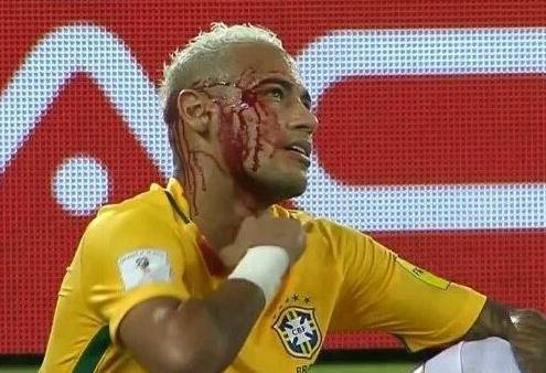 Krvario je za Brazil: Razbio je Boliviju, oni njemu razbili glavu