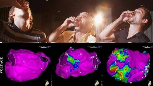 Snimke pokazuju kako na naše srce utječe ispijanje alkohola