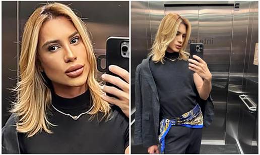 Preminuo poznati influencer: Htio je 'mačji' izgled, a tvrdio je da mu je oči operirao zubar