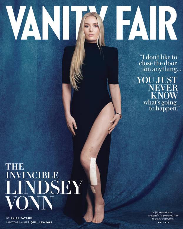 Lindsey Vonn: Ne znam hoću li više ikada stati na skije ili ne. U fazi sam preživljavanja trenutno