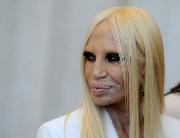 Poznata lica koja su se promijenila zbog velike koli?ine botoksa