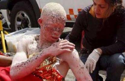 Albino crnac dobio azil da ga ne bi žrtvovali u ritualu