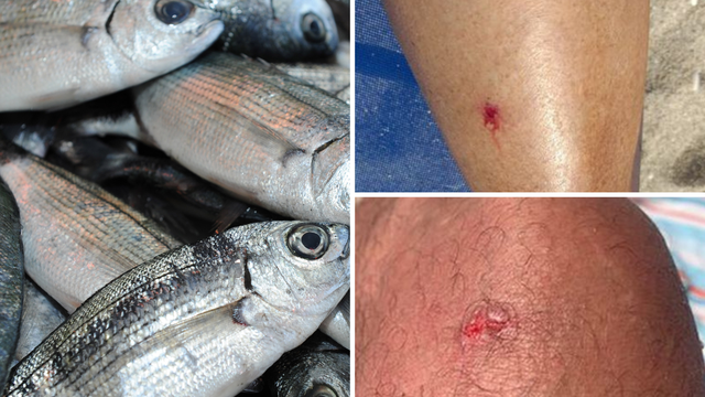 Riba ušata 'napada' kupače u Španjolskoj. Stručnjak: Ugrize li vas, nema ozbiljnih posljedica