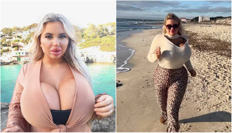 Ugradila 'najveće silikone' pa se snimila kako trči. Obožavatelji: Molim te prestani, to je opasno