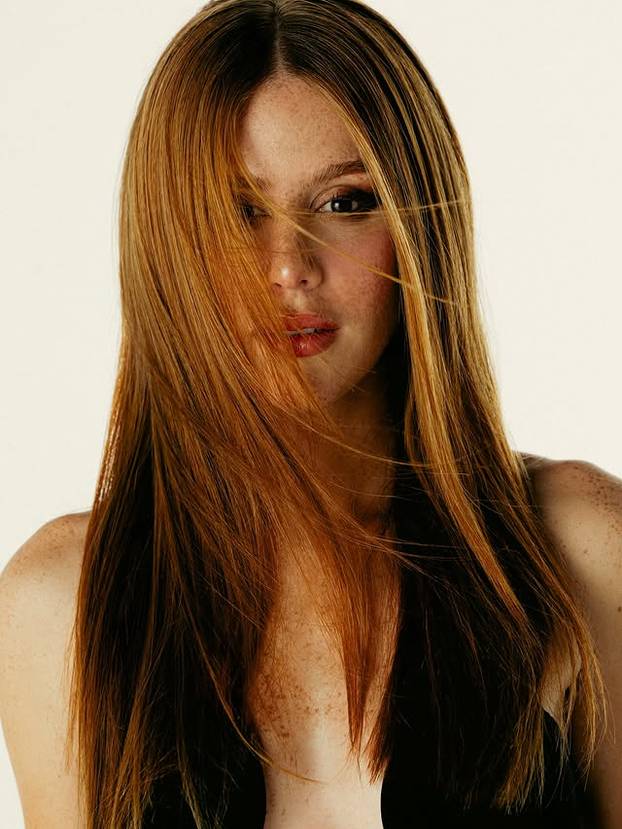 FOTO Posebna ljepota: Milijuni ljudi obožavaju njezine pjegice