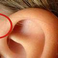 Znate li zašto neki ljudi imaju rupicu kraj uha - a drugi ne?