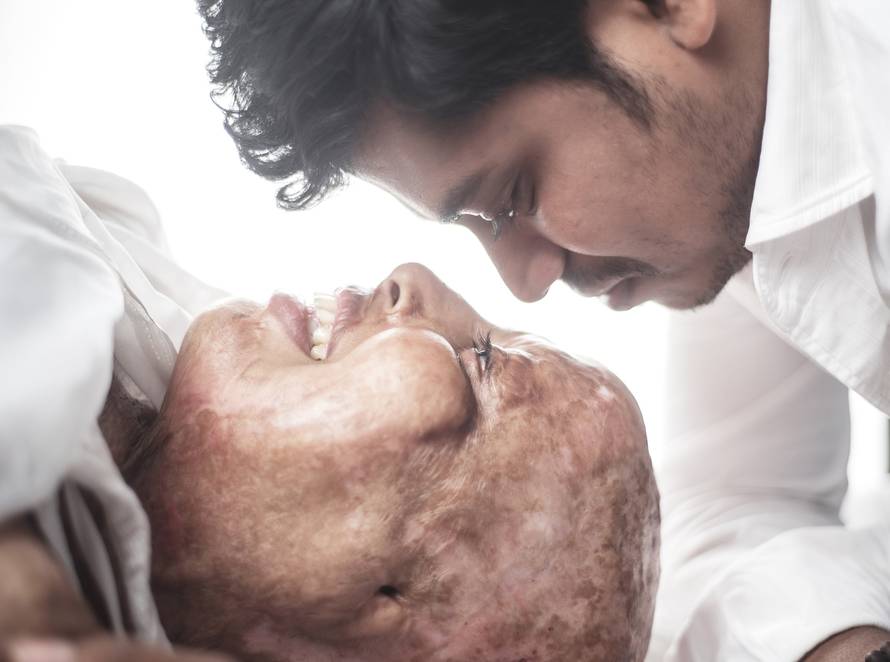ACID ATTACK SURVIVOR FINDS LOVE