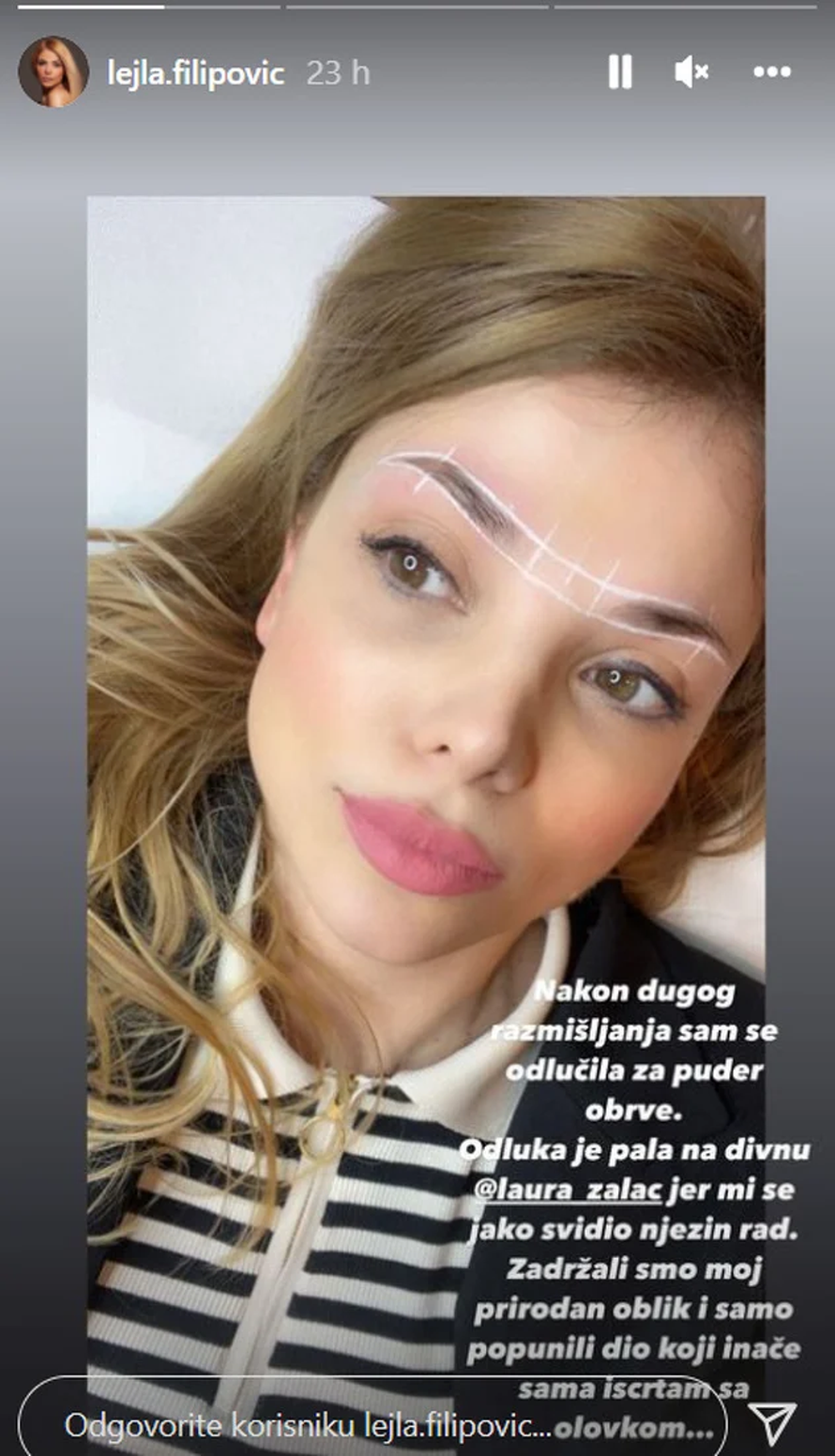 Lejla Filipović pokazala rezultat novog estetskog tretmana: 'Dugo sam razmišljala o ovome'