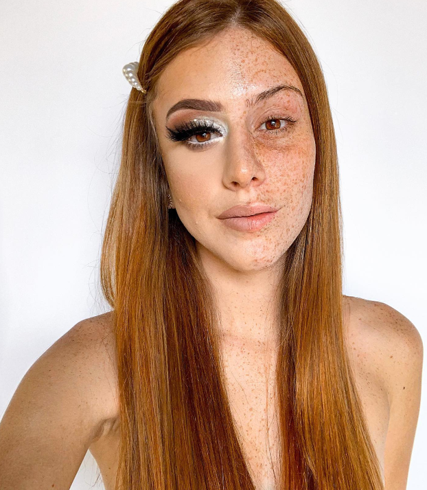 FOTO Posebna ljepota: Milijuni ljudi obožavaju njezine pjegice