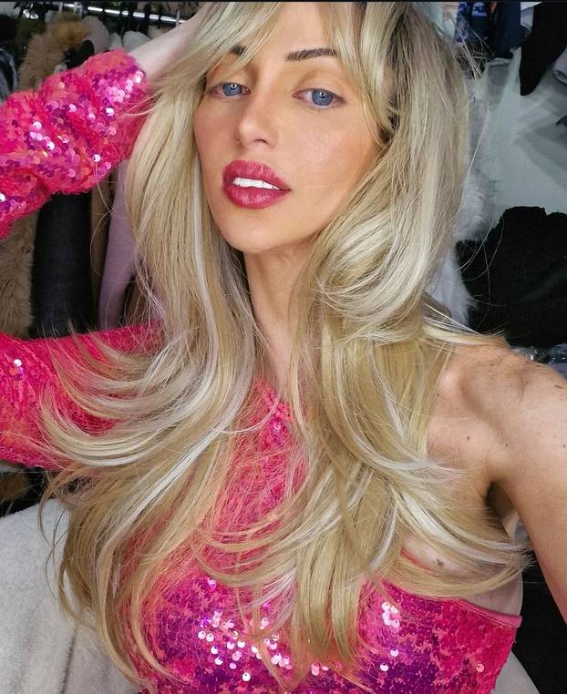 FOTO Mračna strana ovih 'živih' Barbika! Infekcije im 'jedu' kožu i misteriozno umiru. Evo zašto