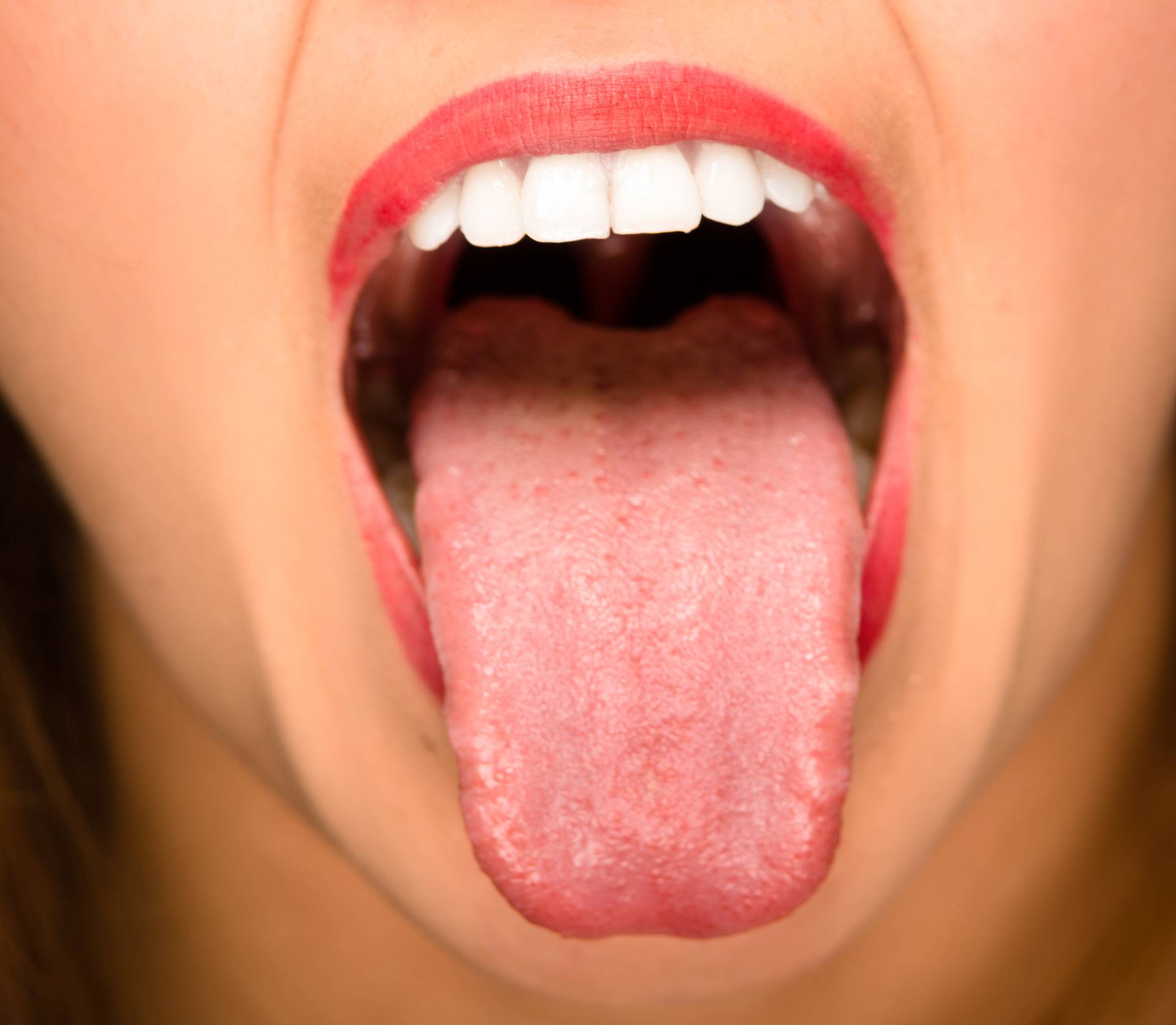 Pogledajte svoj jezik! Otkriva ozbiljne zdravstvene probleme