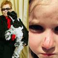 Pas Eltona Johna je izgrizao djevojčicu: Nije se ni ispričao