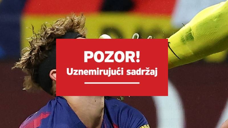 FOTO Zvijezda Barce primila brutalan udarac čepovima u nos