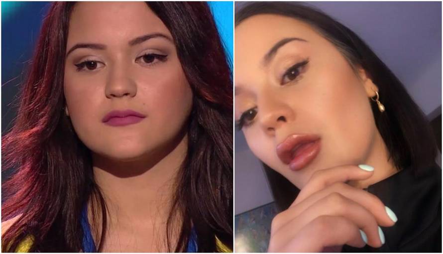 Fanovi tvrde: Povećala je usne Antonia Dora: Ma to je šminka