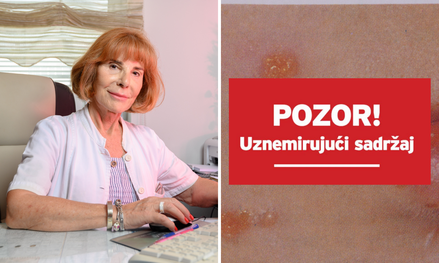 Splićanke pokupile infekciju na plaži, tijelima im se šire kraste. Doktorica: 'Pazite, zarazno je'