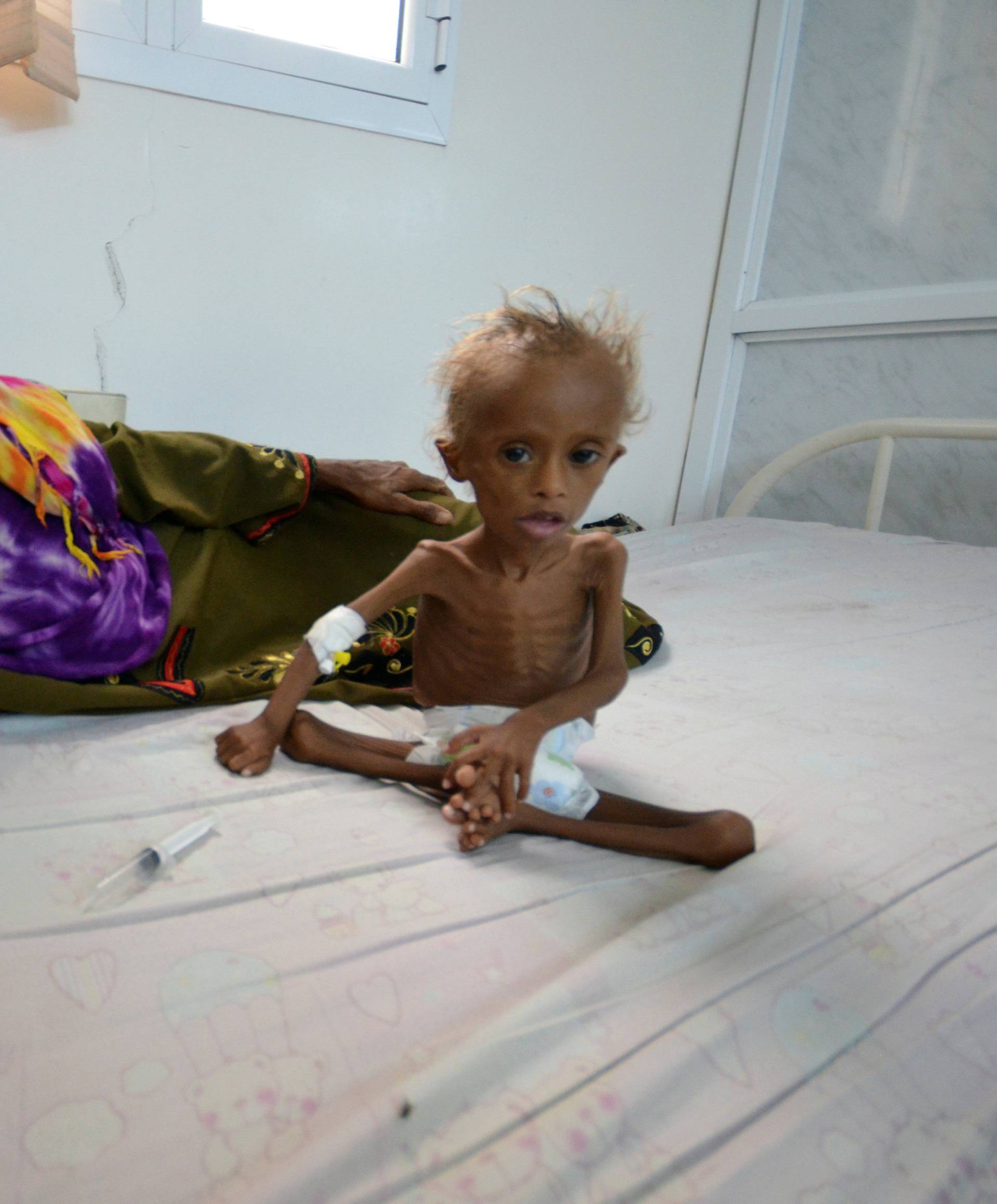 Woman rests on a bed next to her malnourished son at a hospital in the Red Sea port city of Houdieda, Yemen