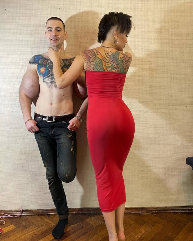 FOTO 'Ruski Popaj' mogao bi izgubiti obje ruke zbog teške infekcije: Ubrizgava kemikalije!